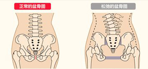 上海妇科医院引进EVA盆底肌修复体系